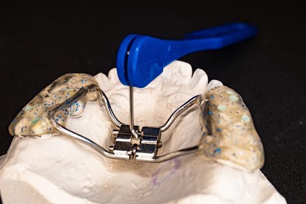 Palatal Expanders: What They Do